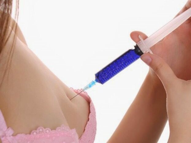 Breast augmentation with hyaluronic acid injection