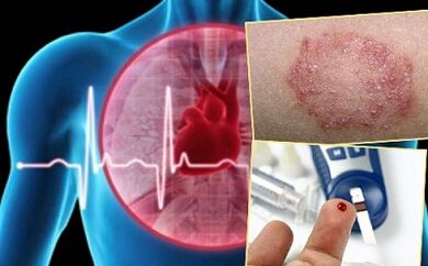 Contraindications of lipolifting