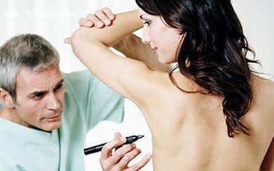 Breast augmentation surgery method