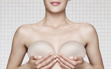 Enlargement of breasts with implants