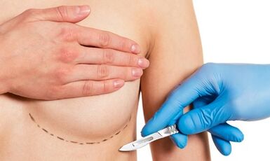 Breast enlargement belonging to implants