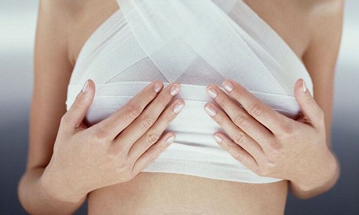 Breasts bandaged after breast augmentation surgery